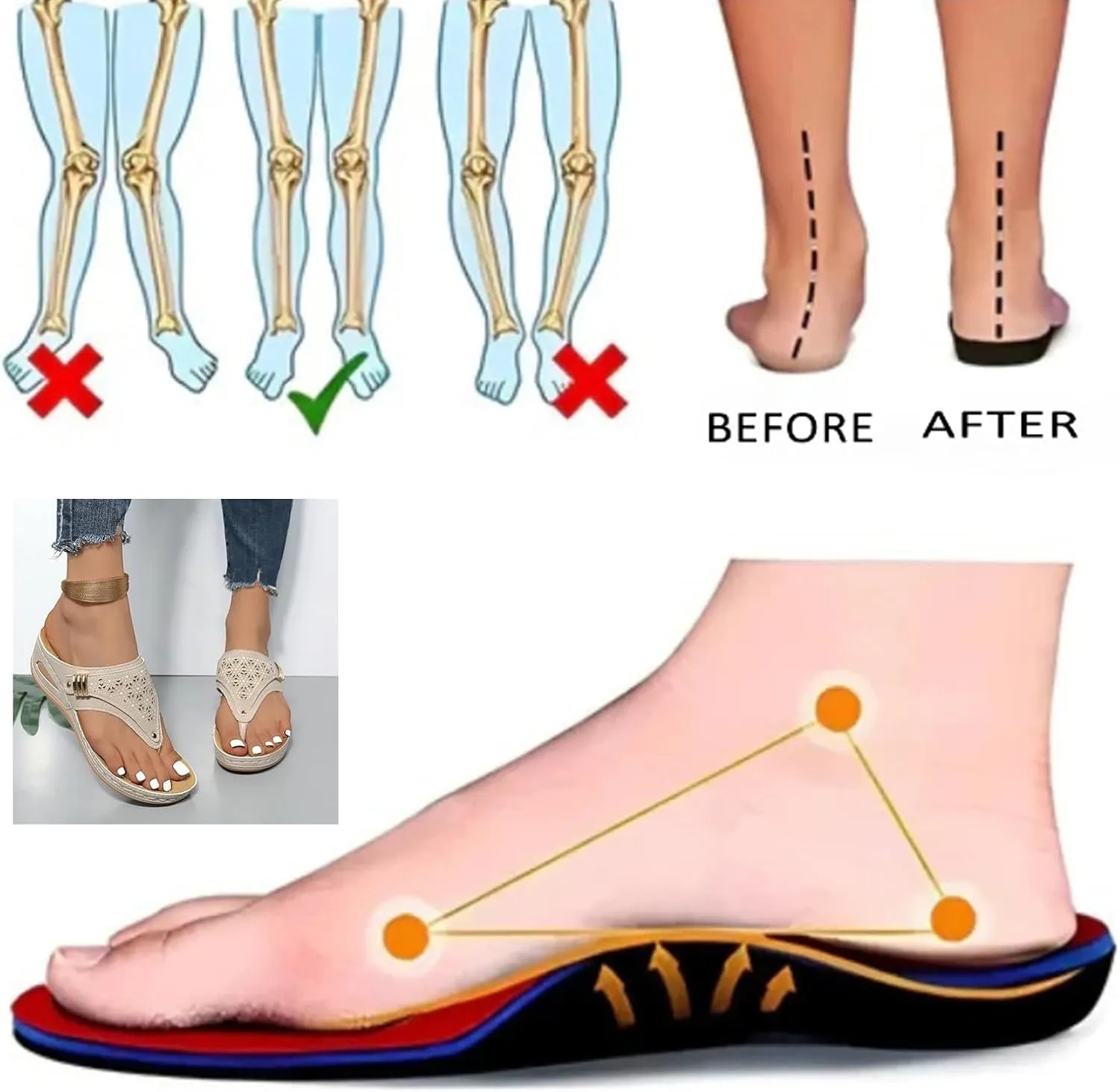 Avylays Orthopedic Sandals,Breathable Mesh Hollow Sports Sandals,Orthopedic Flip-Flops Summer Casual Sandals