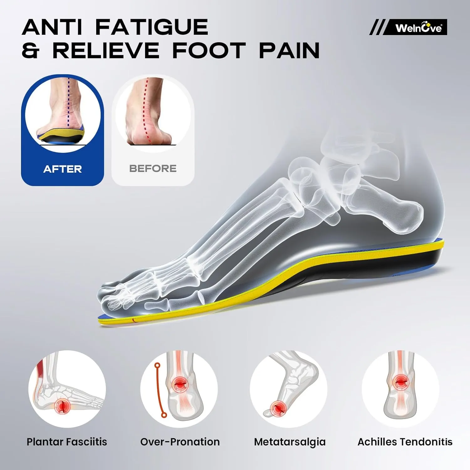 Welnove Plantar Fasciitis Insoles – Sport Arch Support Insoles for Running, Hiking & Standing All Day – Shock Absorption, Heel Pain Relief Heel Spur Insert for Sneakers & Boots(Blue,M)